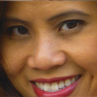 Local Patients AI | Botox®, Dental Fillings and Root Canals